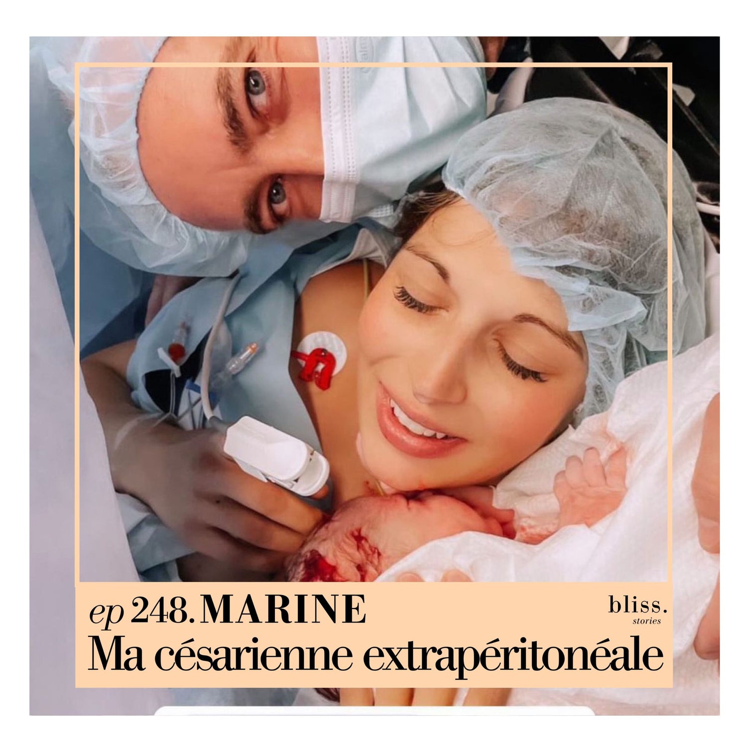 #248 Marine, Ma césarienne extrapéritonéale