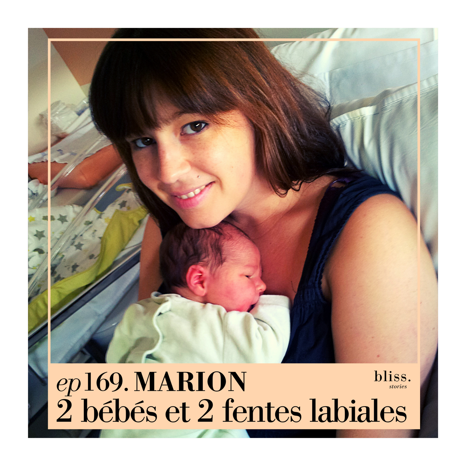 #169 Marion, fente labiale bébé