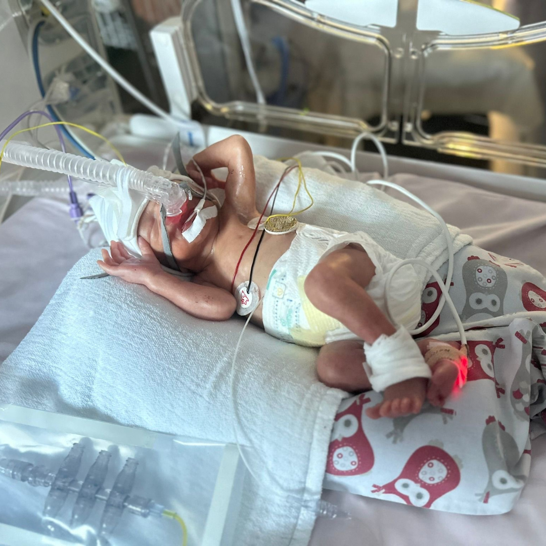 bébé grande prématurée en couveuse – témoignage de prématurité